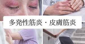 【膠原病】多発性筋炎・皮膚筋炎の特徴と中医学な対処法